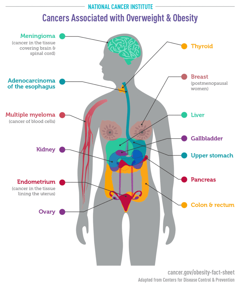 A chart of cancers that are associated with overweight and obesity